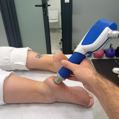 Udarni valovi pri petnem trnu